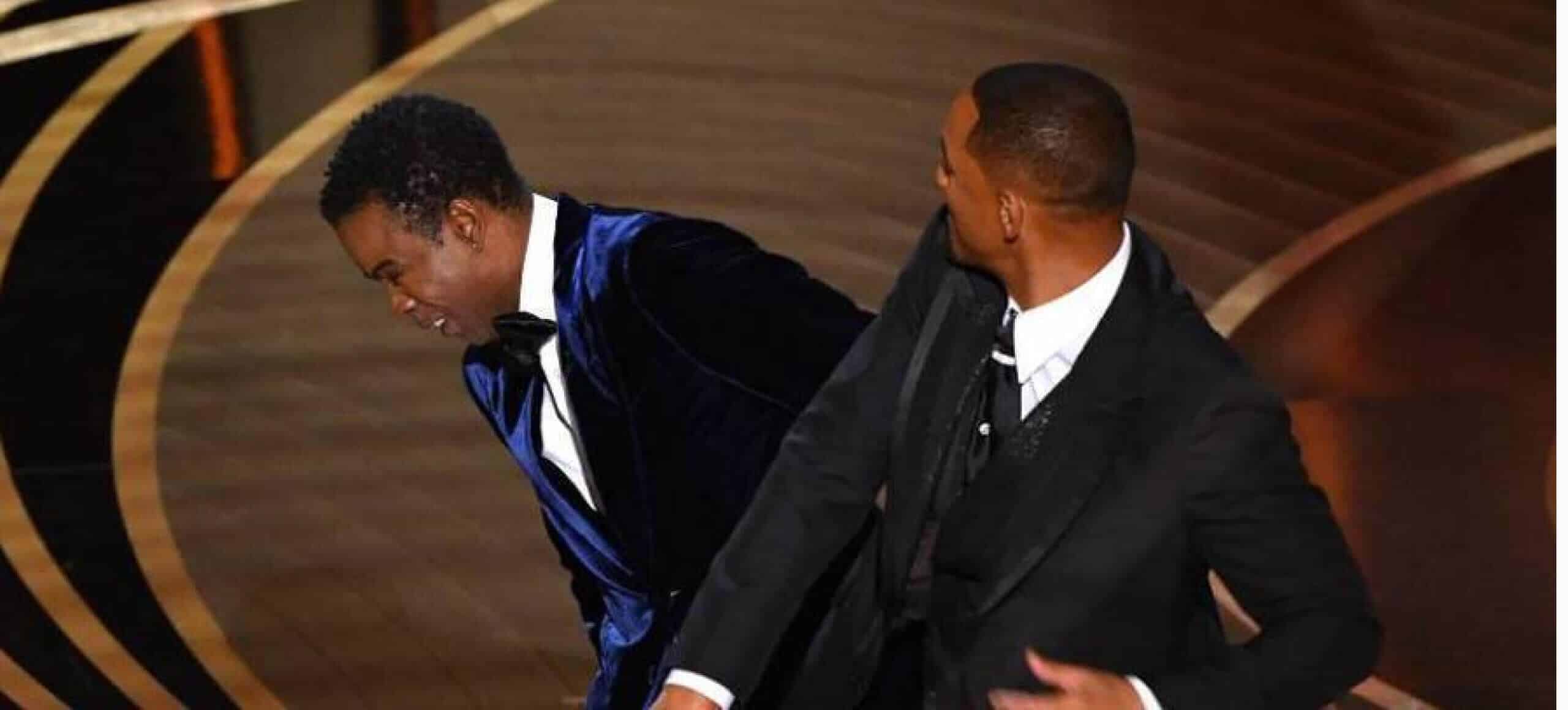 alopecia androgênica