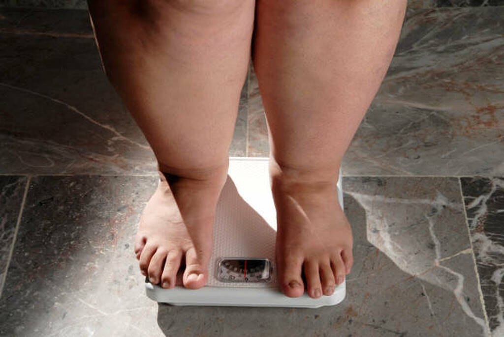 O IMC perde metade dos casos de excesso de adiposidade. A Comissão do Lancet separou obesidade clínica de pré-clínica com 18 critérios.